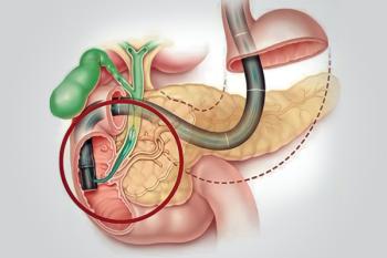 Hepatobiliyer Cerrahi Nedir?